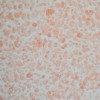 Жидкие обои Silk Plaster - Рельеф